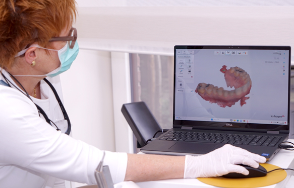 Überprüfung des 3D-Scans auf Vollständigkeit