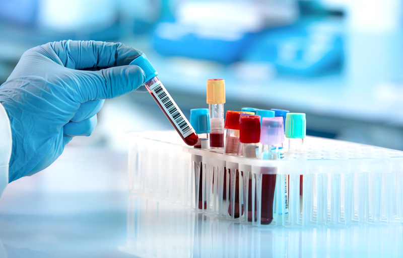 Fotografie mehrerer Glasprobenahmeröhrchen mit Blut in einem Glasständer