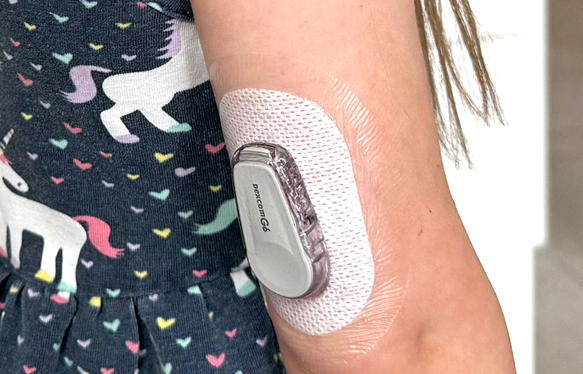 Nahaufnahme einer Insulinpumpe